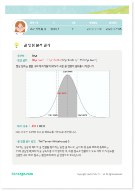 성장키 예측키 뼈나이 골연령 리포트 2