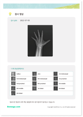 성장키 예측키 뼈나이 골연령 리포트 7